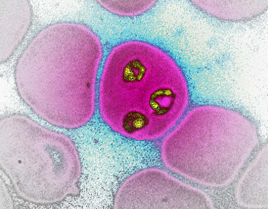 ScienceMagazine's tweet photo. A vaccination strategy for #malaria based on genetically attenuated #Pfalciparum can protect healthy volunteers from controlled malaria infections, shows a phase 2 trial reported in @ScienceTM. https://t.co/FDPAZNSutu https://t.co/NbyrrC4i94