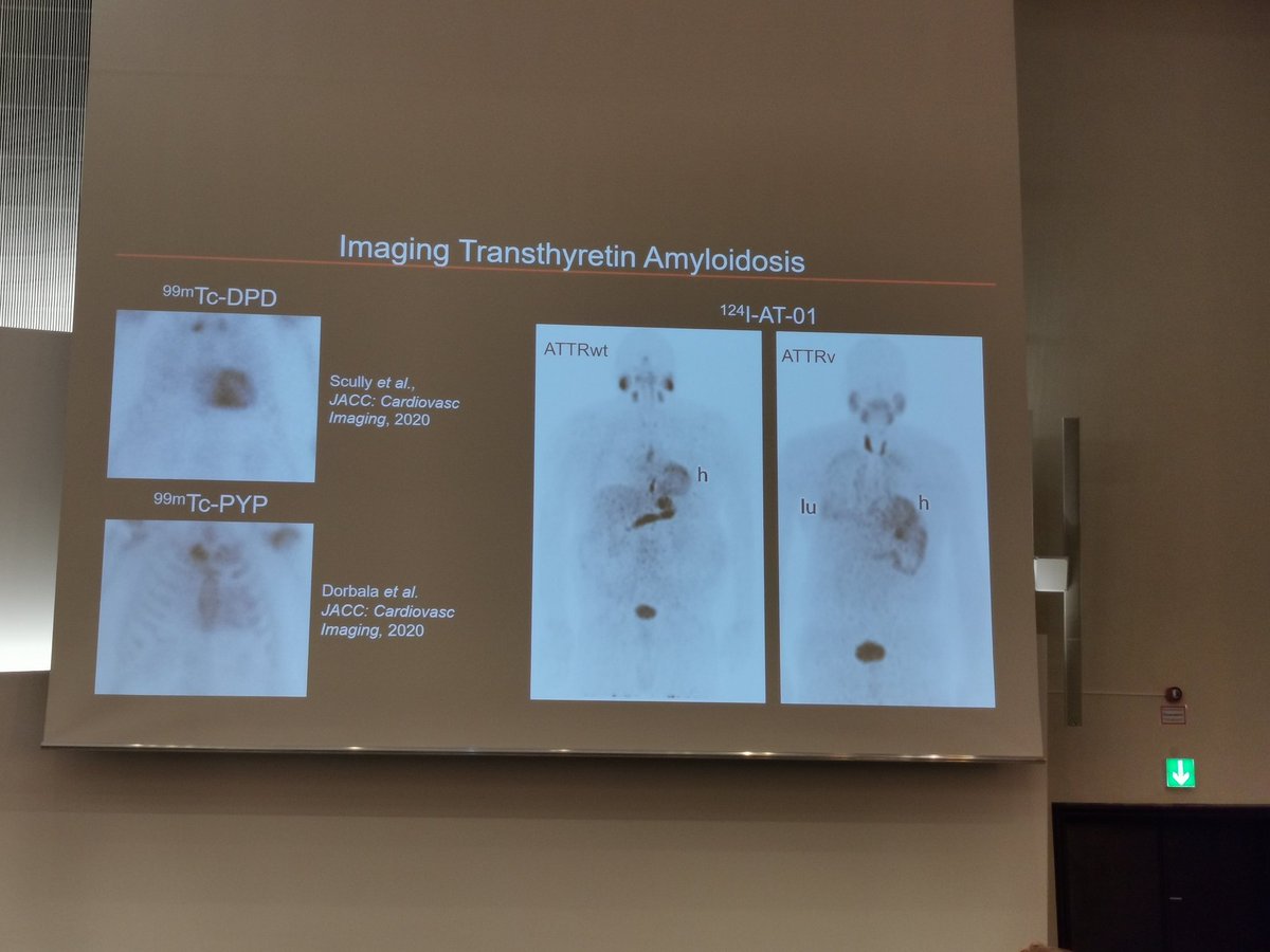 estelais's tweet photo. #ISA_2022 imaging with 124-I-AT-01? yes, it's a reality 🙌 by Jonathan Wall from #TennesseeUniversity @ISA_Amyloidosis 2/2 https://t.co/qEpQ1dmdzp