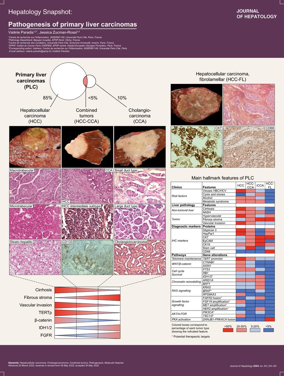JHepatology's tweet photo. 🆕Hepatology Snapshot❕

Pathogenesis of primary liver carcinomas

By @valerieparadis &amp; @Zucmanrossi

Find it here👉https://t.co/Zd8kJVjj5T

#PrimaryLiverCancer
#HCC
#CCA
#LiverTwitter https://t.co/wHLqY80Qhn