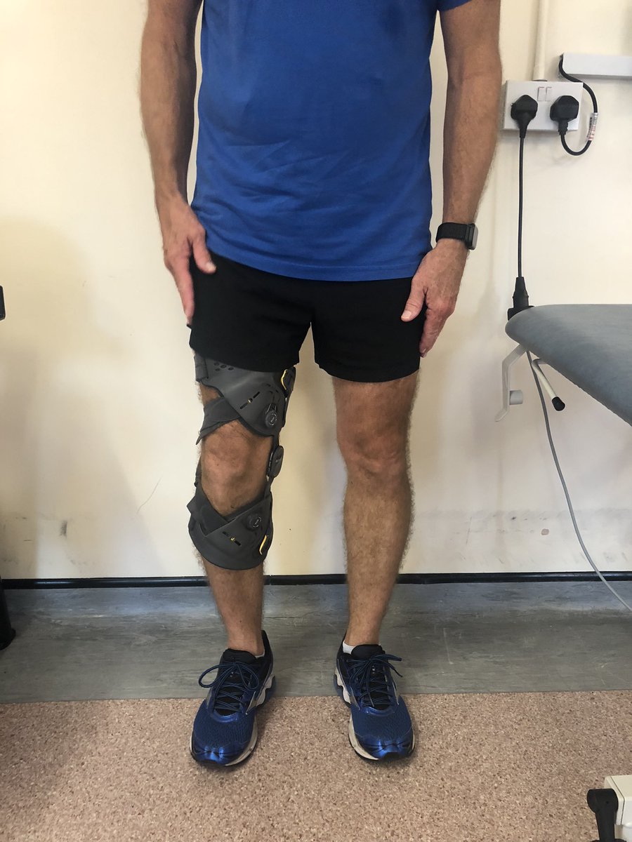 Patient Consent. One of our patients has been fitted with the unloader x by our physio team. Indications for use - ACL deficient with medial compartment OA. 8/52 post fitting his VAS and WOMAC scores have significantly improved. <a href="/OssurCorp/">Össur</a> #knee #OA #ACL #rehab #physio