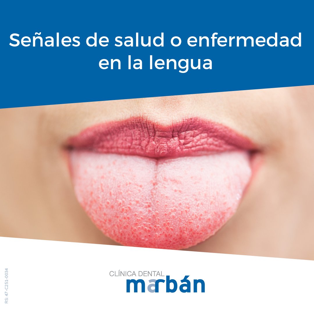 El color y la textura de la lengua te da pistas 👅 sobre tu salud .
Lo normal es que presente un aspecto brillante y sea de color rosa. 
➡️ bit.ly/3PYyzUm
#TodasLasSonrisasNosRespaldan #FelizJueves