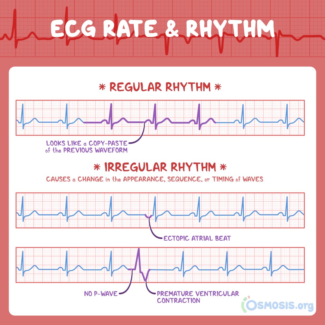 Osmosis On Twitter The Most Important Thing You Should Know About ECG osmosis-on-twitter-the-most-important-thing-you-should-know-about-ecg