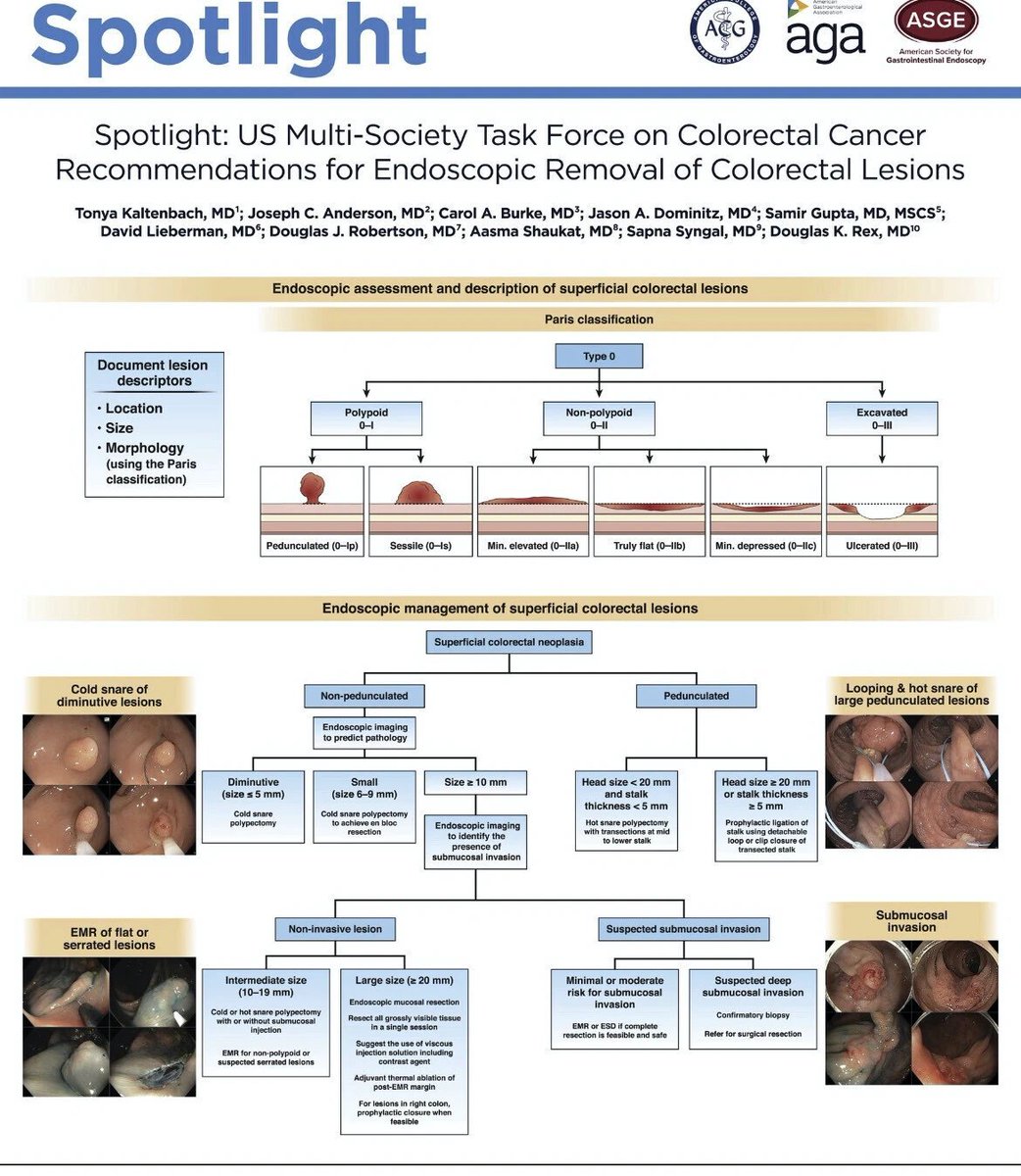 Recommendations for Endoscopic Removal of Colorectal Lesions via @ASGEendoscopy