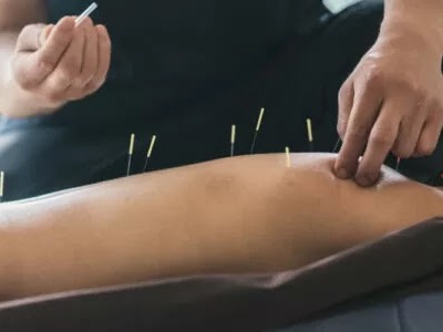 HealthSourcePT's tweet photo. If you’re suffering from chronic pain, acupuncture could be a great solution. It has been proven to stimulate the endorphin system which can result in reduced pain and inflammation.
https://t.co/W3aogXJsej

#HealthSourcePT #PhysicalTherapy #PhysicalTherapists #Acupuncture https://t.co/arH573EOMZ