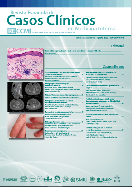 RECCMI_SEMI's tweet photo. 🆕Publicado el Volumen 7⃣ - Núm. 2⃣ de 2022 de la Revista Española de #CasosClínicos en #MedicinaInterna (#RECCMI) de 
@Sociedad_SEMI 
🩺¡No te lo pierdas!
 #SEMItuit @RECCMI_SEMI @GrupoCTO
🔵Casos clínicos de este número⬇️
https://t.co/MUlElRDhy4 https://t.co/p0SkJbeJ9H