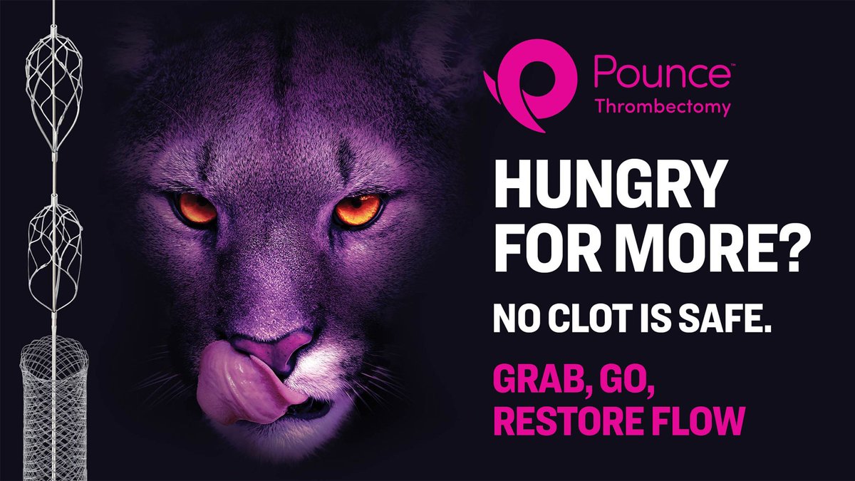 Surmodics's tweet photo. HUNGRY FOR MORE? The Pounce™ #Thrombectomy System was designed to remove peripheral arterial clot quickly. Grab, go, and restore flow. No clot is safe. For more, visit https://t.co/fIhY3aXG31. RX only. #Clotcha #TwittIR #CardioTwitter https://t.co/BBL5wGTAaB