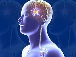 A Promising Therapy for Hard-To-Treat Depression: Deep Brain Stimulation
#depression #Anxiety #journal #openaccess #research #article #submission