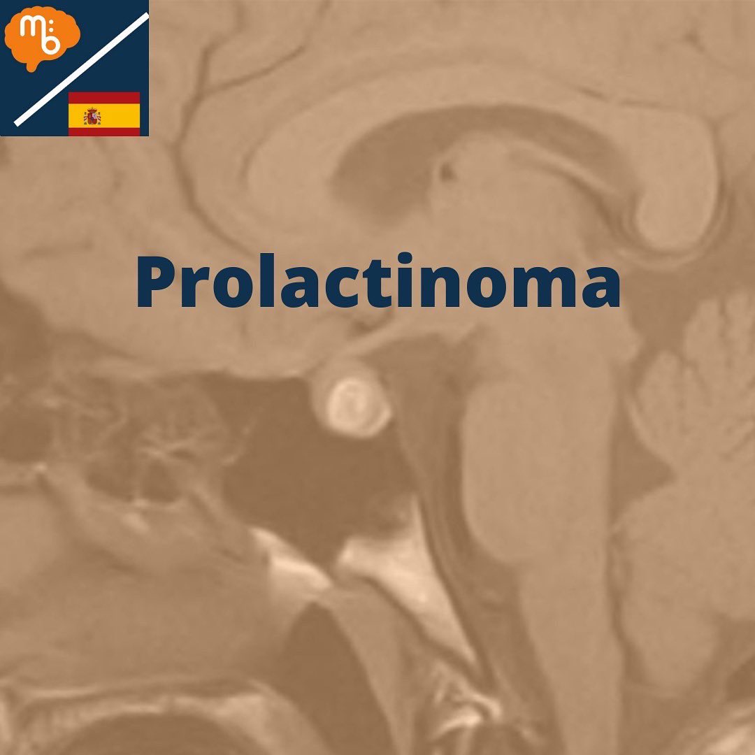 Mission:Brain Complutense tweet media