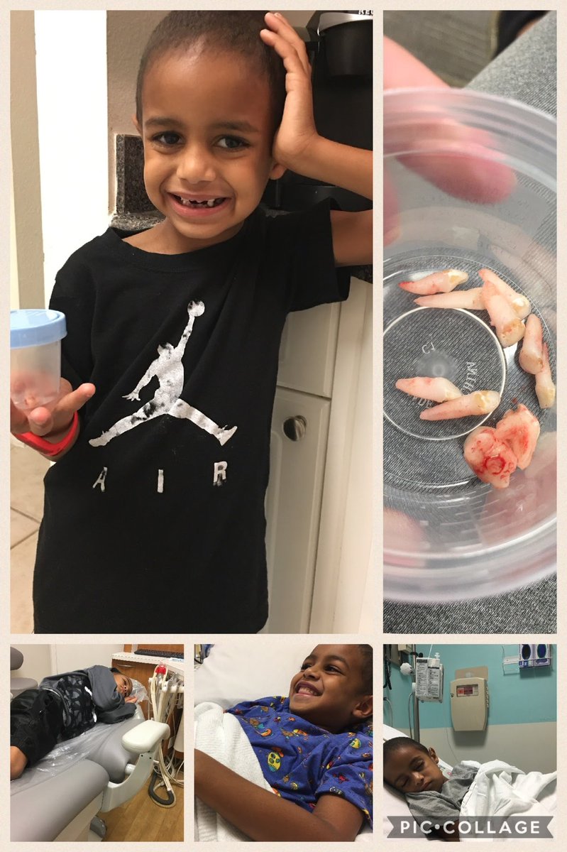 jbentle21's tweet photo. Day 5…side effects suck..Childhood Cancer Awareness..a pic a day of our warrior on his journey.Started in Apr 2015(3)&amp; he’s here today(10) still fighting.Strongest person I know!No child should ever have to experience this! #neuroblastomawarrior #cancersucks #fightformore 💙🎗💙 https://t.co/ogUCaAgpt3