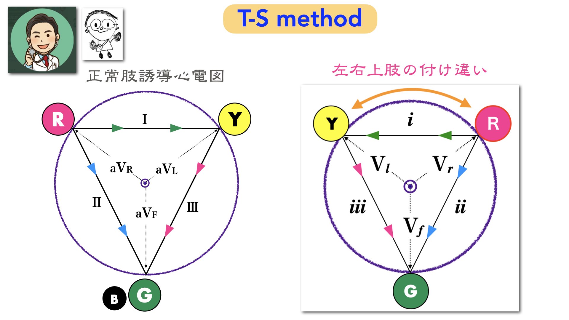 N. Tsukishima EP大学心電図検定学部試験対策科担任 on X: 