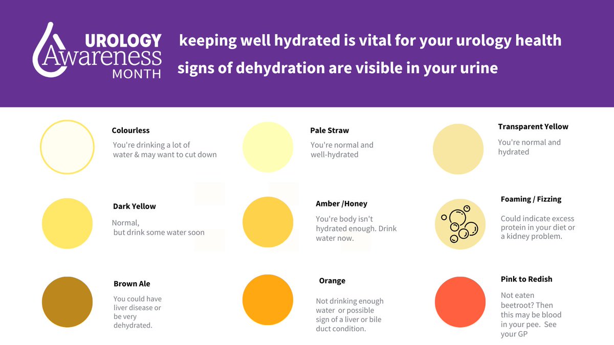 TUF_tweets's tweet photo. Keeping well hydrated is vital for your urology health and the colour of your urine is a very good guide to how well hydrated you are #urologyhealth #UAM22 #hydration #keepwellhydrated #knowthesigns #TUF to find out more about urology visit https://t.co/qwWpYwPgVq https://t.co/WwHSgh8ELM