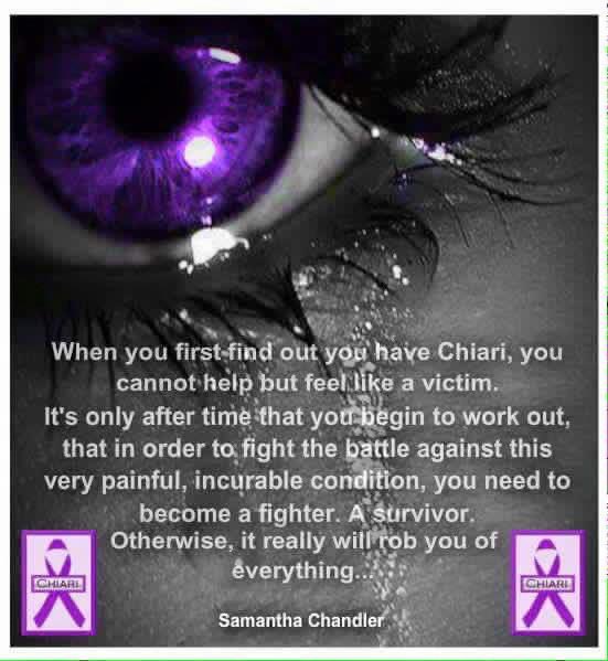 nicolesylvie's tweet photo. Day 5 of Chiari Malformation Awareness month #ChiariMalformationAwareness #chiarimalformation #chiarilife https://t.co/IxSIbCAQyU