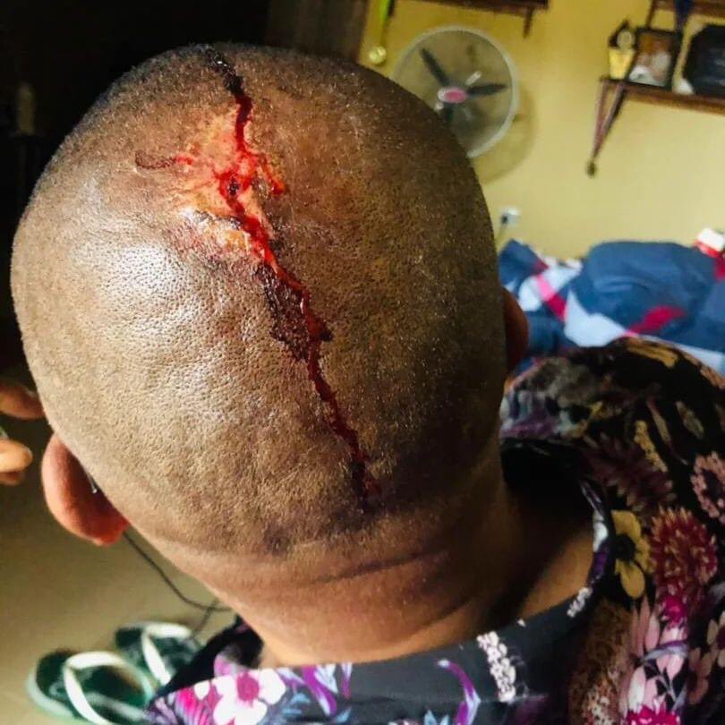 Appreciating the IG of Police for arresting four of persons among that attacked actor Steve Eboh, aka, Ajebo.
I want to thank the Inspector General of Police for this response.
Nollywood has done very well for Nigeria so Actors shouldn't be objects of verbal or physical attacks.
