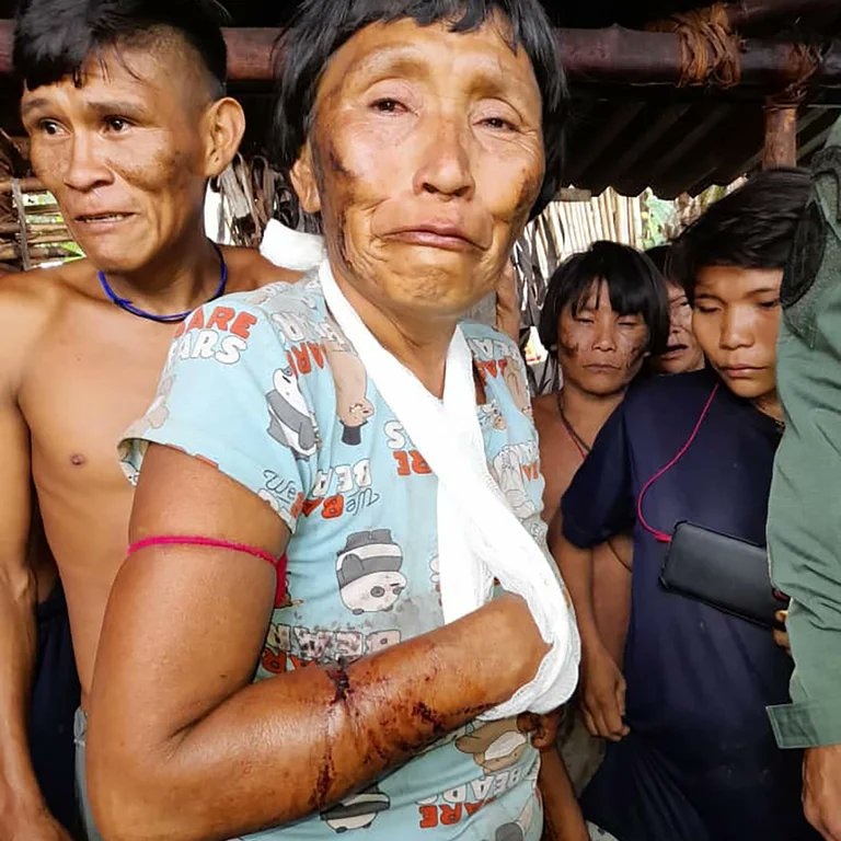Fritz_A_Sanchez's tweet photo. En serio? Hacen una publicación sobre el #DiaInternacionalDeLaMujerIndigena aún cuando mantienen impune la masacre perpetrada x efectivos d la aviación contra la comunidad yanomami de #ParimaB #AltoOrimoco !
#AusenciaEstadoDeDerecho
#VenezuelaFragmentada https://t.co/g7b0rJHRNP