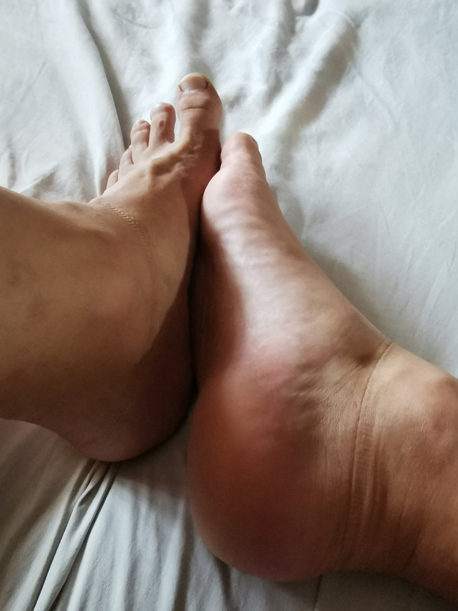 Masterfeet79's tweet photo. #feetfethish #guyfeet #feet #gayfeet #feetpicsforsales #feetfetiche #FOOTFETİSH #footfetısh #socks #socksforsale #sockenfetish https://t.co/y43A6oLK0B