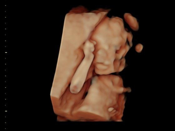 ithillienxb's tweet photo. Confirmadisimo. It's a girl!! Y sí, ya tiene nombre... Empieza por A, como su padre 🥰🥰🥰🥰🥰🥰🥰 #papigamer #babygamer #itsagirl #love #family #familygrows #baby https://t.co/rz4yVEiuLZ