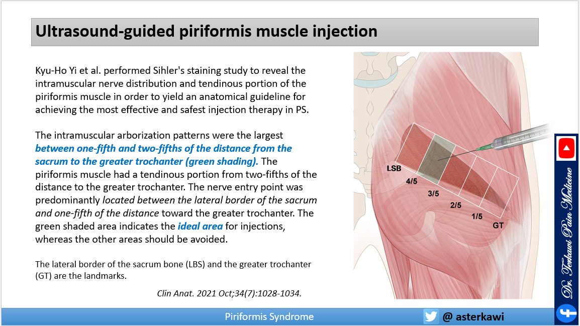 asterkawi's tweet photo. Where is the ideal point for piriformis injection? Why? 
Learn more about piriformis syndrome: https://t.co/qTXxxV6uIP 

#piriformissyndrome #piriformis #Buttockpain #backpain #chronicpain #nerveblock https://t.co/JReLHI5Kqr