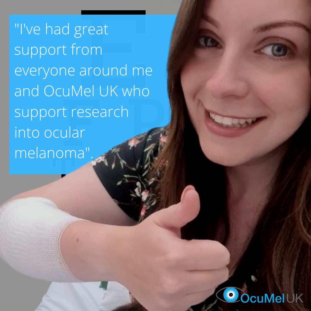 OcuMelUK's tweet photo. Megan was diagnosed with ocular melanoma in 2020. 
Her tumour caused her vision to deteriorate. She was told 4 months ago that her cancer had spread to the liver and that the cancer is uncurbable. Regular eye checks can detect the cancer &amp; potentially save lives. @Eveningnews.💙 https://t.co/C6Mo0gwlLP