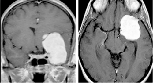 Neurosurgical Atlas tweet media