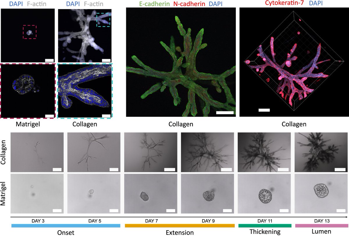 Nature Communications (@naturecomms) on Twitter photo <a href="/arispapargyriou/">Aristeidis Papargyriou</a> <a href="/MaxReichertMD/">Maximilian Reichert</a> <a href="/Bauschlab/">BauschLab</a> <a href="/LabReichert/">Reichert Lab</a> et al. provide insights into #PancreaticCancer branching morphogenesis with #organoids that can recreate branched structures, and with a minimal mathematical model
#CancerResearch <a href="/natrescancer/">Cancer at Nature Portfolio</a>
go.nature.com/3TKT2Pl <a href="/arispapargyriou/">Aristeidis Papargyriou</a> <a href="/MaxReichertMD/">Maximilian Reichert</a> <a href="/Bauschlab/">BauschLab</a> <a href="/LabReichert/">Reichert Lab</a> et al. provide insights into #PancreaticCancer branching morphogenesis with #organoids that can recreate branched structures, and with a minimal mathematical model
#CancerResearch <a href="/natrescancer/">Cancer at Nature Portfolio</a>
go.nature.com/3TKT2Pl