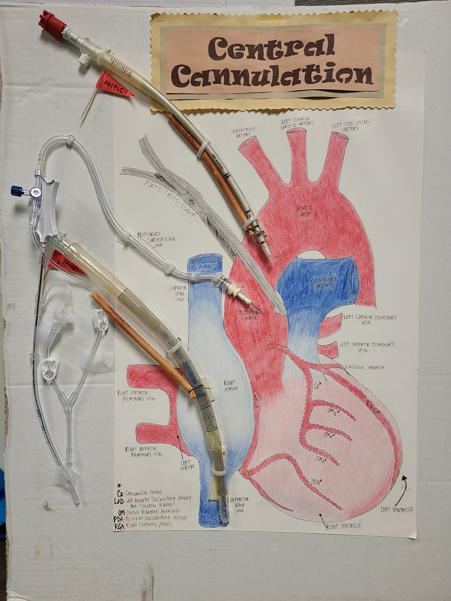 Cannulation and cross clamping . Helped me a lot understanding, when I first rotated on cardiac. Amazing drawing by Methodist perfusionist