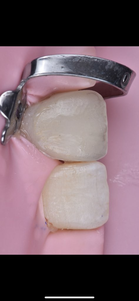 dentestetik37's tweet image. #cementation #isolation