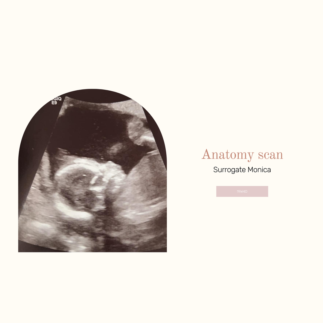 surrogatefirst's tweet image. Look at that little tootsie ! 

#anatomyscan #ivfgotthis #embryotransfer #intendedparents #surrogacy #surrogacyrocks #stickythoughts #babydust #family #ivf #fet