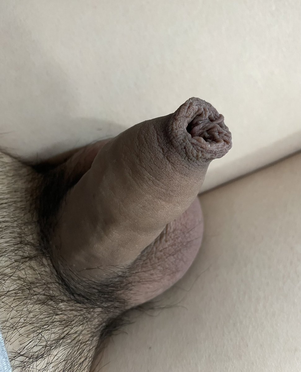 30Ulid's tweet photo. 以前包皮退回去都會覺得包皮卡一半在裡面，就會一直拉。
結果包皮越拉越長都變尖的，是不是有人很愛也有人很痛恨包皮?

#包皮過長 #包皮 #短小 https://t.co/3llRheSlMm