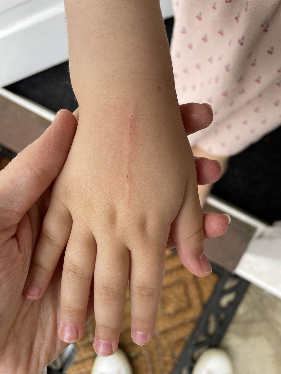 ShulaPannick's tweet photo. @waitrose one of your youngest shoppers was not very happy today when a sharp edge on your trolley hurt her scanning hand :( https://t.co/CVVJO9n4XA