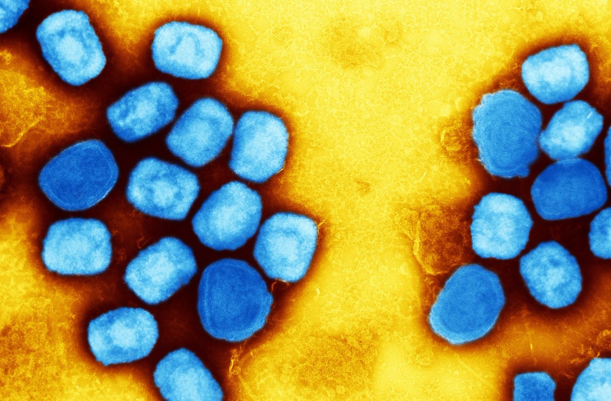NewsMedical's tweet photo. Impact of vaccinia virus-based vaccines on the 2022 monkeypox virus outbreak https://t.co/GfEVZQmObn #Monkeypox #Vaccinia #Virus #vaccines #immunity #genetic #Tcells #antibodies #epitopes #Dryvax #ACAM2000 #MVABN @VirusesMDPI @UniMelb @hkust @TheDohertyInst https://t.co/eVO1j5ea5J