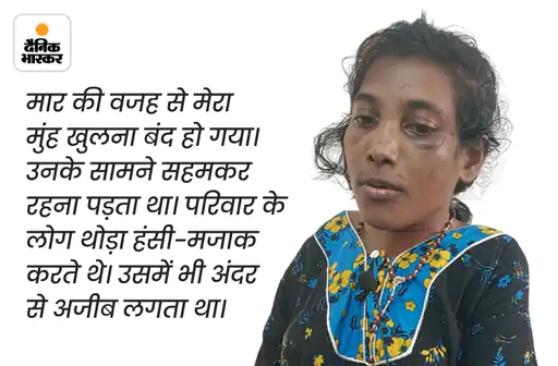DainikBhaskar's tweet photo. рдкрд┐рдЯрд╛рдИ рд╕реЗ рдЖрджрд┐рд╡рд╛рд╕реА рдорд╣рд┐рд▓рд╛ рдХрд╛ рдкреИрд░ рддреЛрдбрд╝ рджрд┐рдпрд╛: рд╕реБрдиреАрддрд╛ рдмреЛрд▓реА- рдореИрдбрдо рдЧрд░реНрдо рддрд╡реЗ рд╕реЗ рдорд╛рд░рддреА рдереАрдВ, рдЦреБрдж рдХреЛ рдмрдЪрд╛рдиреЗ рдореЗрдВ рд╣рд╛рде рдЬрд▓ рдЧрдП
#Jharkhand #BJP #Seemapatra
рдЕрдзрд┐рдХ рдЦрдмрд░реЗрдВ рдФрд░ рдореБрдлреНрдд рдИ-рдкреЗрдкрд░ рдкрдврд╝рдиреЗ рдХреЗ рд▓рд┐рдП рджреИрдирд┐рдХ рднрд╛рд╕реНрдХрд░ рдРрдк рдЗрдВрд╕реНрдЯреЙрд▓ рдХрд░реЗрдВ - https://t.co/hO3HVqcM49 https://t.co/tNebHdJ0mY