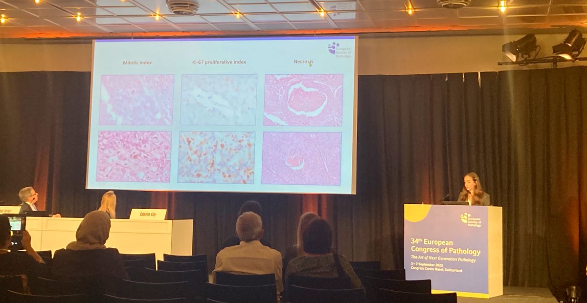 RyCPatologia's tweet photo. Presentación de @carmen_ap7 - High-grade medullary thyroid carcinoma, morphological features and prognostic value of the international grading system #rycpath #entpath #ECP2022Basel https://t.co/qCwckD1vJ8