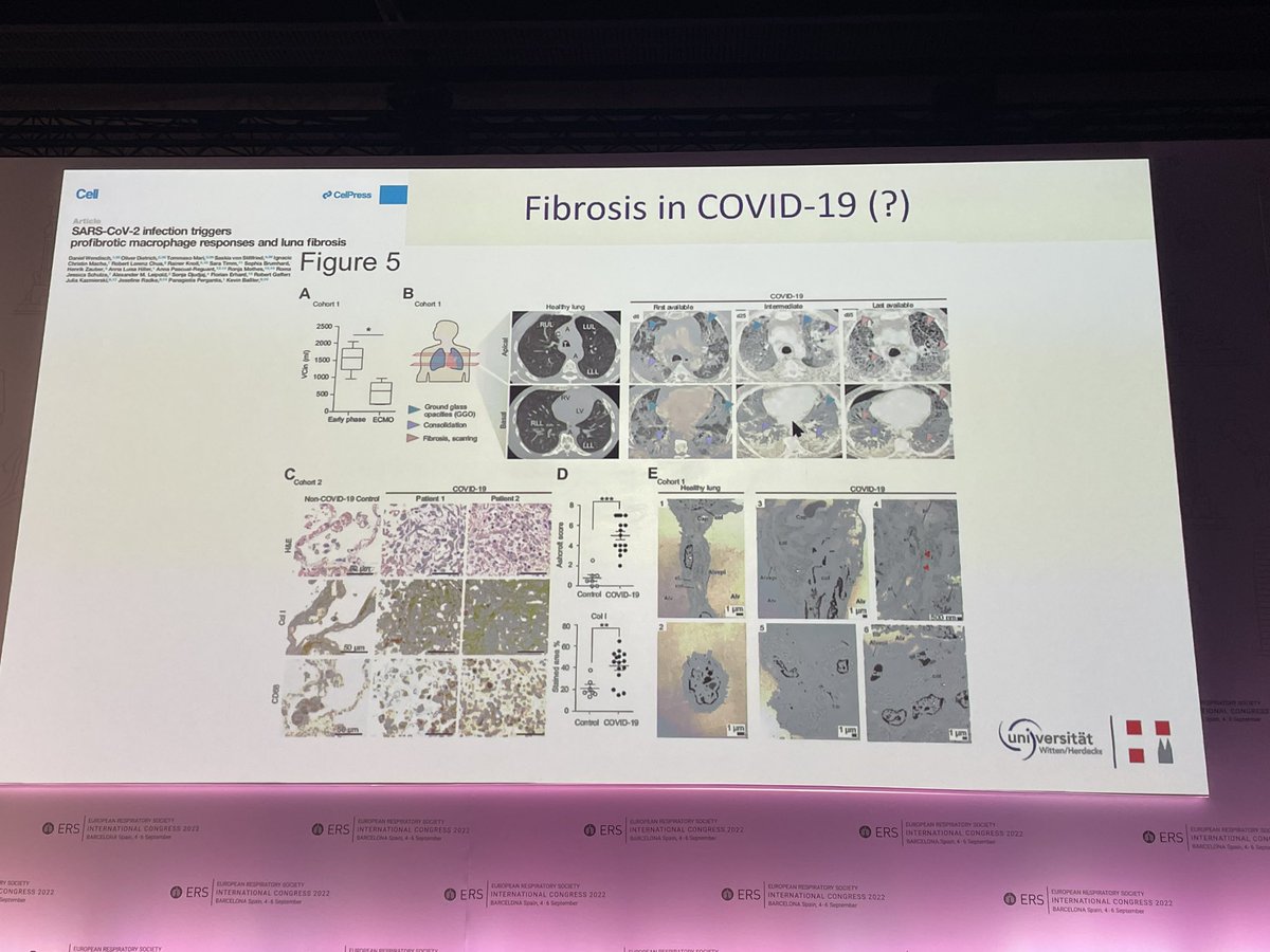 Management of adults with COVID-19 in the intensive care unit! Excellent talk from Christian Karagiannidis <a href="/ERSAssembly2/">ERS Assembly 2</a> #ERSInternationalCongress2022 <a href="/EuroRespSoc/">ERS</a>