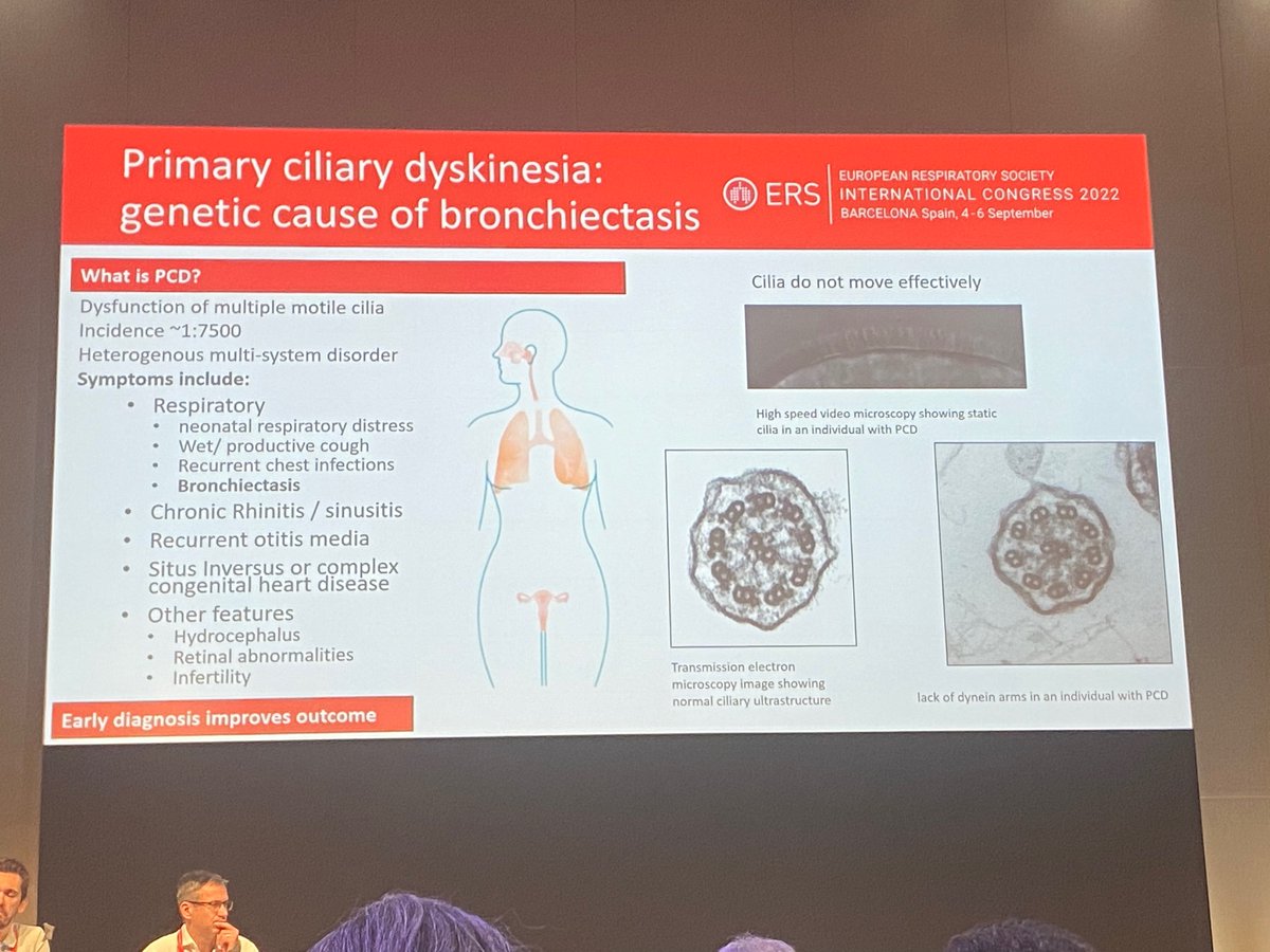 FionaMosgrove's tweet photo. @Shoemelia discussing PCD and under diagnosis in patients with bronchiectasis. #ERSInternationalCongress2022 https://t.co/n5qjMvvMQd