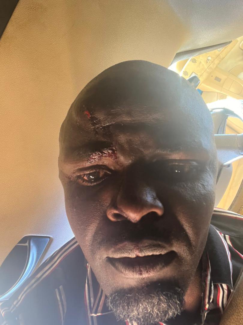 advocatemahere's tweet photo. ⛔️ALERT: There’s been an escalation of violence in Gokwe ahead of a rally to be addressed by Change Champion in Chief, @nelsonchamisa. Journalists Tongai Mwenje, Toneo Rutsito, Pellagia Mpurwa and Chelsea Mashayamombe have been heavily beaten by ZANUPF thugs. Toneo lost a tooth. https://t.co/hxIJzhPZ1M