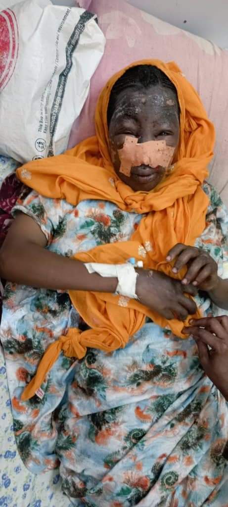 alafarey_h's tweet photo. TPLF targets defenseless civilians in #yallo Afar region, the mother below was injured yesterday 24 Agust 2022, and her two children was killed along with nine civilians in the same attack
#TPLFisaTerroristGroup @POTUS @hrw @AmnestyEARO @UNHumanRights https://t.co/CnaTzkAmz1