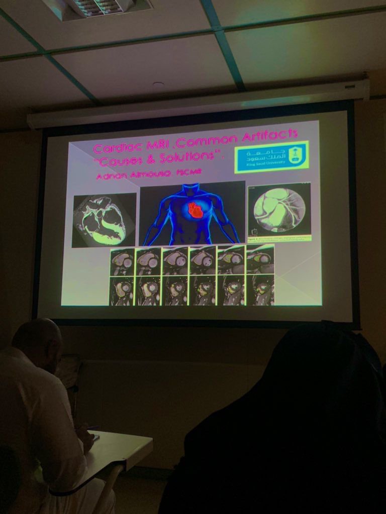 ashalruwaili's tweet photo. اول تجربة استضافة للاخصائي القدير عدنان
@pscccmr
رشحته لي وحدة قالت مستحيل بتلقين ��حسن منه للكاردياك
جلست معه لقاء ٤٥ د نرتب فيه للكورس خلال هالجلسة سوا سحر وعطاني كورس كاردياك😱قدرة هائلة على تبسيط العلم وتحفيز تعلمه والاعجب الكل اتفق معي من الحضور كذلك,يوم ناجح❤️‍🔥
#MRIcourseKSU https://t.co/jfNDifuRdI