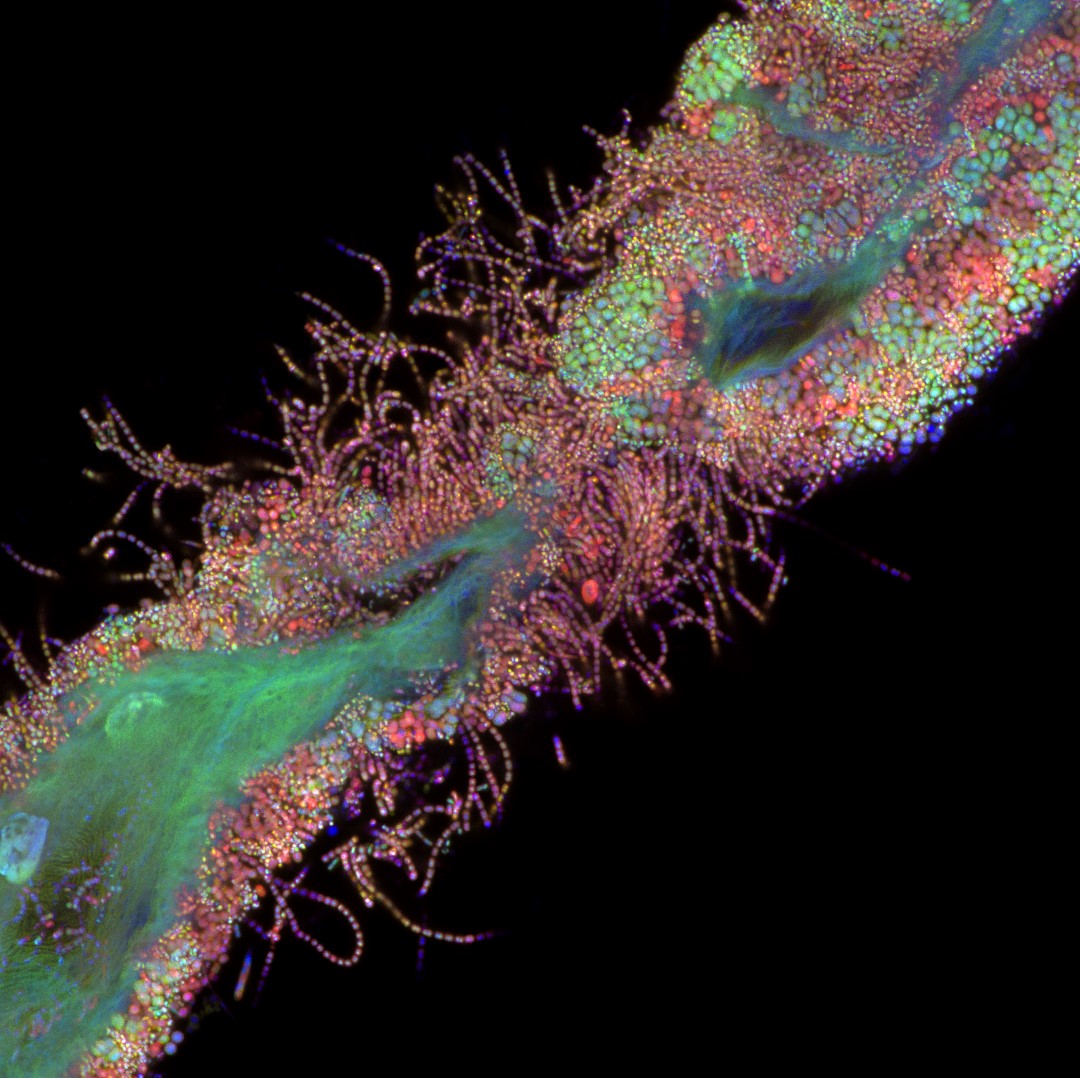 zeiss_micro's tweet image. Life Sciences: 
Bacteria bound to epithelial cells of the human tongue | Tagide deCarvalho, University of Maryland, Baltimore County 
 #ZEISSImageContest
