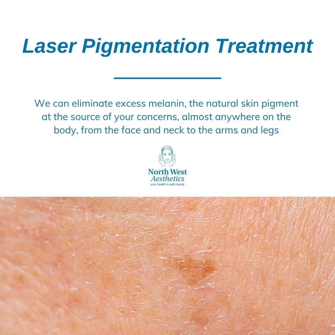 demt82's tweet photo. "Results aren't guaranteed when you try to treat your #pigmentation concerns at home with over-the-counter products. Try advanced laser treatment at #NWA for a visibly clearer complexion!

We can eliminate excess melanin almost anywhere on the body - https://t.co/BRMQmPcmLX https://t.co/EbdmsBV0qK