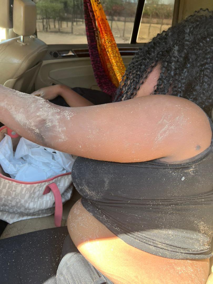 daddyhope's tweet photo. ZANUPF thugs have violently attacked Zimbabwean journalists who were covering an opposition @CCCZimbabwe rally being addressed by Zimbabwe’s main opposition leader @nelsonchamisa

Chamisa had to be whisked to safety.

Journalist @toneo1st lost a tooth in the ZANUPF violence. https://t.co/mO32W71reJ