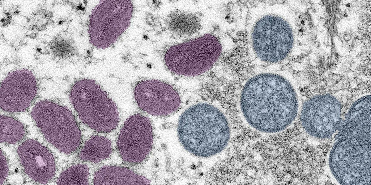 ez2stop's tweet photo. If you have #monkeypox, you’re infectious from the time symptoms start until they’re resolved and the rash is all healed. You should isolate at home if possible. For more about what you should do if you have monkeypox, visit @CDCgov: https://t.co/eF2tFDStIx https://t.co/ZpwB0x4soE