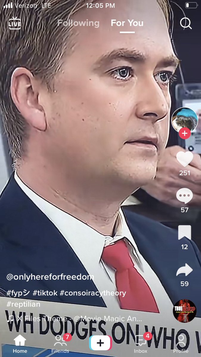 RichAnthony1984's tweet photo. @pdoocy What’s up with ur ear. They got u? Masks on masks off https://t.co/Cem3yNcHA8