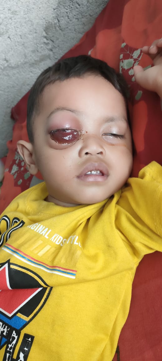achmadsodri's tweet photo. Butuh bantuan nya untuk para dermawan..sekarang lagi di rs cipto..hub orang tua ny langsung +62 882-1961-1941 https://t.co/4esecbEmv1