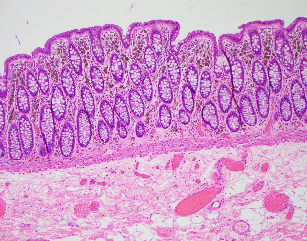 Nicole Mendelson MD tweet media