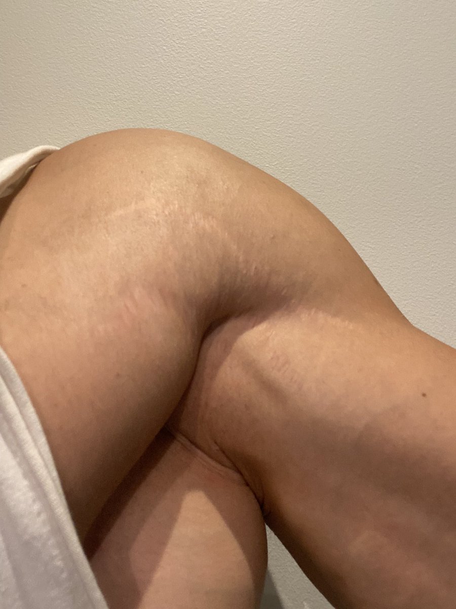 TiboInShape's tweet image. Aimez vos vergetures ! C’est le signe de votre progression