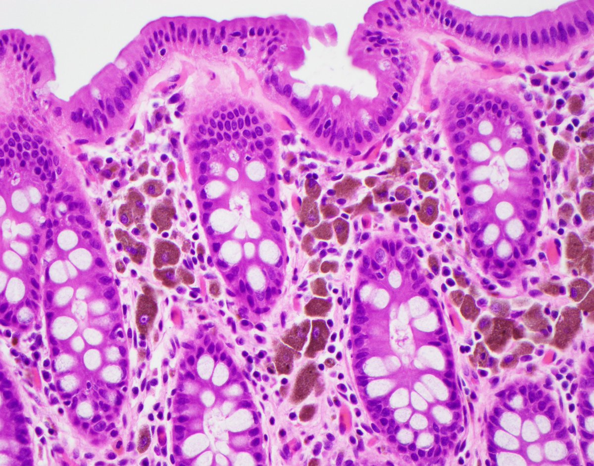 Nicole Mendelson MD tweet media