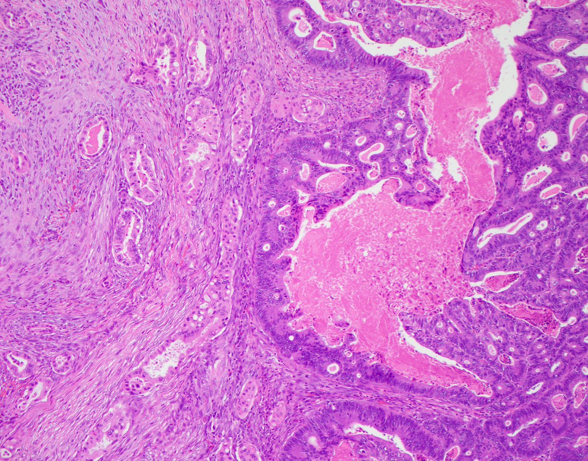 Nicole Mendelson MD tweet media