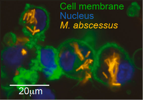 MedCambridge's tweet photo. Phenogenomic analysis – a new approach combining phenotyping & whole genome sequencing – has been developed by @luc_boeck and @AndresFloto’s group (@flotocambridge) to reveal insights into bacterial pathobiology.
https://t.co/WTYUxIYZl3
#medicinecambridge #LMBResearch https://t.co/Xj6umxtdq6