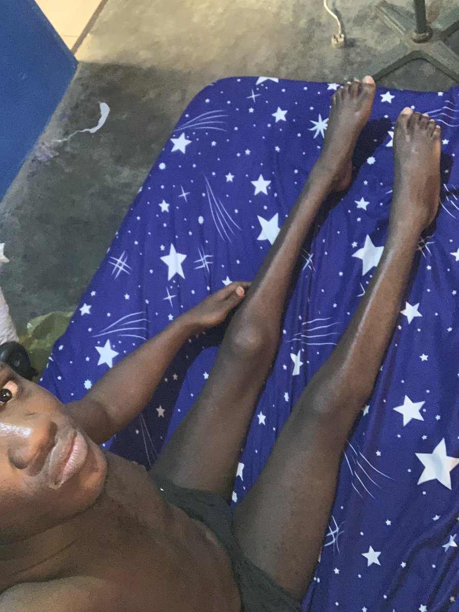 Tundeolubori's tweet photo. Pls I need a help My name is Tunde Lawal I was robbed &amp; shot at my backbone in a one chance commercial bus at oshodi while heading home from work at night which has left me unable to walk with my legs as we speak.The doctor suggested a surgery but money causes delay.Pls help Me🙏🏾 https://t.co/NS8jEQnaVA