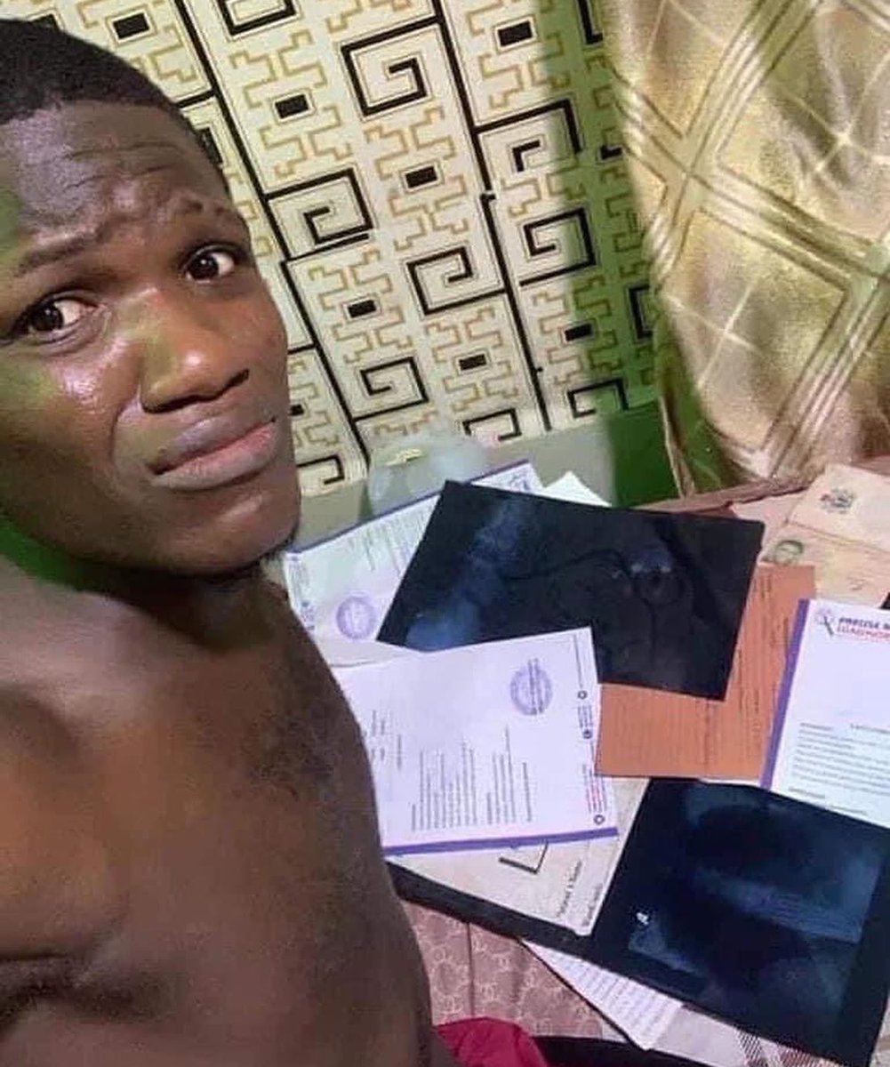 Tundeolubori's tweet photo. Pls I need a help My name is Tunde Lawal I was robbed &amp; shot at my backbone in a one chance commercial bus at oshodi while heading home from work at night which has left me unable to walk with my legs as we speak.The doctor suggested a surgery but money causes delay.Pls help Me🙏🏾 https://t.co/NS8jEQnaVA